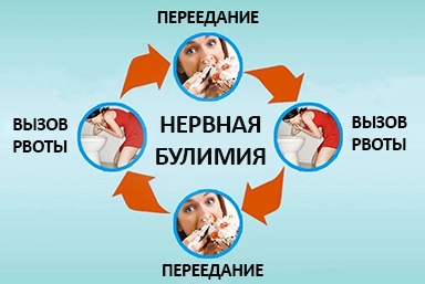 Лечение булимии в Сагопши